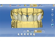 inLab Software 4.0