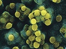 Link Between Oral Bacteria and Cardiovascular Inflammation