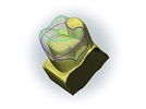 Another Step Forward in the Age of Digital Dentistry – CEREC inLab 4.0