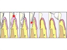 Health Indicators - Cholesterol or Periodontitis?