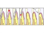 Health Indicators - Cholesterol or Periodontitis?