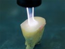 Plasma Makes Its Dental Debut