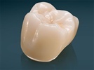 Lava Plus High Translucency Zirconia