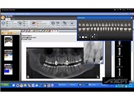 Carestream Dental Announces Partnership With XCPT to Integrate Synapshot Treatment Planning and Patient Communication Software Into Its Practice Management Solutions