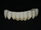 The Best of Both Worlds: How Press-to-Zirconia Restorations Combine Brawn and Beauty to Deliver Reliable Results