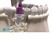 Product Overview: Trabecular Metal Dental Implant System from Zimmer Dental