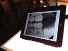 New Dental Products: DEXIS Announces New DEXIS Imaging Suite and Upcoming DEXIS go iPad App