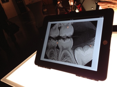  New Dental Products: DEXIS Announces New DEXIS Imaging Suite and Upcoming DEXIS go iPad App