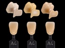 3M Adds WIELAND to the List of Companies Licensing its Zirconia Coloring Technology