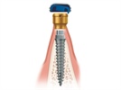 New Dental Product: LOCATOR Overdenture Implant System from ZEST Anchors