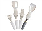 New Dental Product: Open Platform Inclusive Tooth Replacement Solution from Glidewell Laboratories