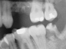 The American Dental Association Issues Updated Recommendations for Dental X-rays