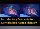 Webinar: Introductory Concepts to Dental Sleep Apnea Therapy