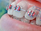 Houston Ortho Practice Creates Complimentary Online Consultation System