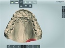 TRIOS Ortho Digital Impression Solution