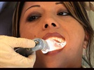 Video Testimonial: A Practice's Experience Selecting and Implementing Isolite Systems