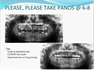 Webinar: Utilization of Digital Radiography in Pediatric Dentistry
