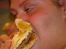 Increased Risk of Gum Disease Linked to Being Overweight