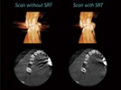Enhanced Dental Product: Gendex Adds Scatter Reduction Technology to the GXDP-700 Cone Beam System