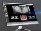 Cliosoft 2.0 Dental Imaging Software