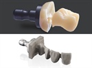 New Dental Products: DENTSPLY Debuts CELTRA Glass Ceramic and Crypton Cobalt Chrome Alloy CAD/CAM Materials at IDS