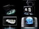 New Dental Product: CS Solutions Chairside CAD/CAM from Carestream Dental