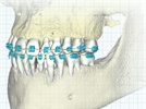 Carestream CS 9300C Select Certified for Use with suresmile Orthodontic System