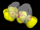 Worn Teeth Are Less Likely to Suffer Fatigue Failure