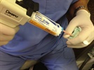 Dental Product Review: DEFEND Temporary Crown and Bridge Material