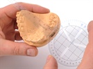PalaMeter, a Clinical Measurement Tool from Heraeus Kulzer, Wins U.S. Patent