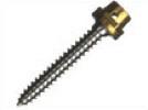 ERA Mini Dental Implant