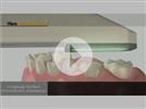 Video: Cadent iOC Scanner