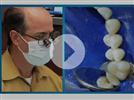 Video: Herculite Ultra Posterior Restoration with Dr. LeSage