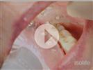 Video: Dental Imaging with Isolite