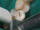 Video: Vertise Flow - Chapter 1 - Liner