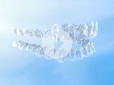 Video: Align Technology, Inc. - Invisalign G3 Technology