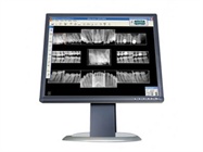 A Dental Hygienist’s Guide to Digital Radiography