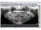 Digital Imaging More Than the WOW Factor
