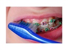 Orthodontic Dental Hygiene Care Plan
