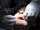 Minimally Invasive Dentistry 101
