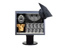 Maintaining Your 3-D Momentum with Cone-Beam Imaging