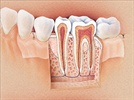 Periodontal Diagnosis and Treatment: Lasers, Chemotherapeutics, and Guided Tissue Regeneration