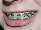 The Case for Ortho: An Interview with Dr. Brock Rondeau