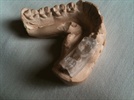 Dental CAD/CAM and Cone Beam CT Combined: State-of-the-Art Care in Implant Dentistry