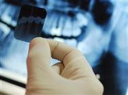 Are Dental X-Rays Risky Business?