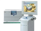 Chairside Economical Restoration of Esthetic Ceramic (CEREC)