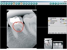 Digital Radiography - What You Need to Know Before Going Digital