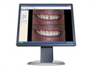 Cosmetic Imaging From The Dental Laboratory