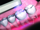 Digital Impressions = More Predictable Dentistry