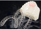 Red White and Blue Orthodontic Aligners